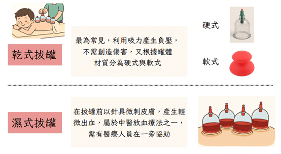 拔罐全面解析：種類、效用與使用方式的最新科學觀點
