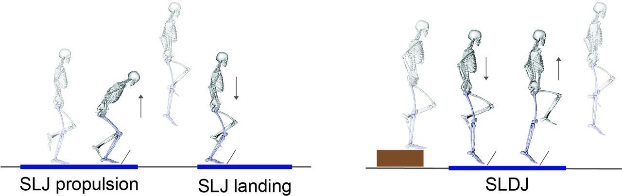 你真的準備好了嗎?ACL術後重返運動的新評估依據:垂直跳