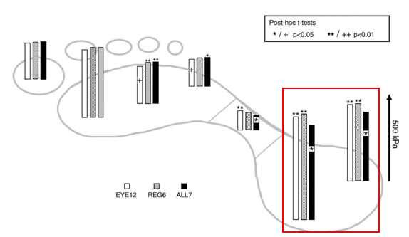 綁鞋帶的方式對跑步的影響原來這麼大!