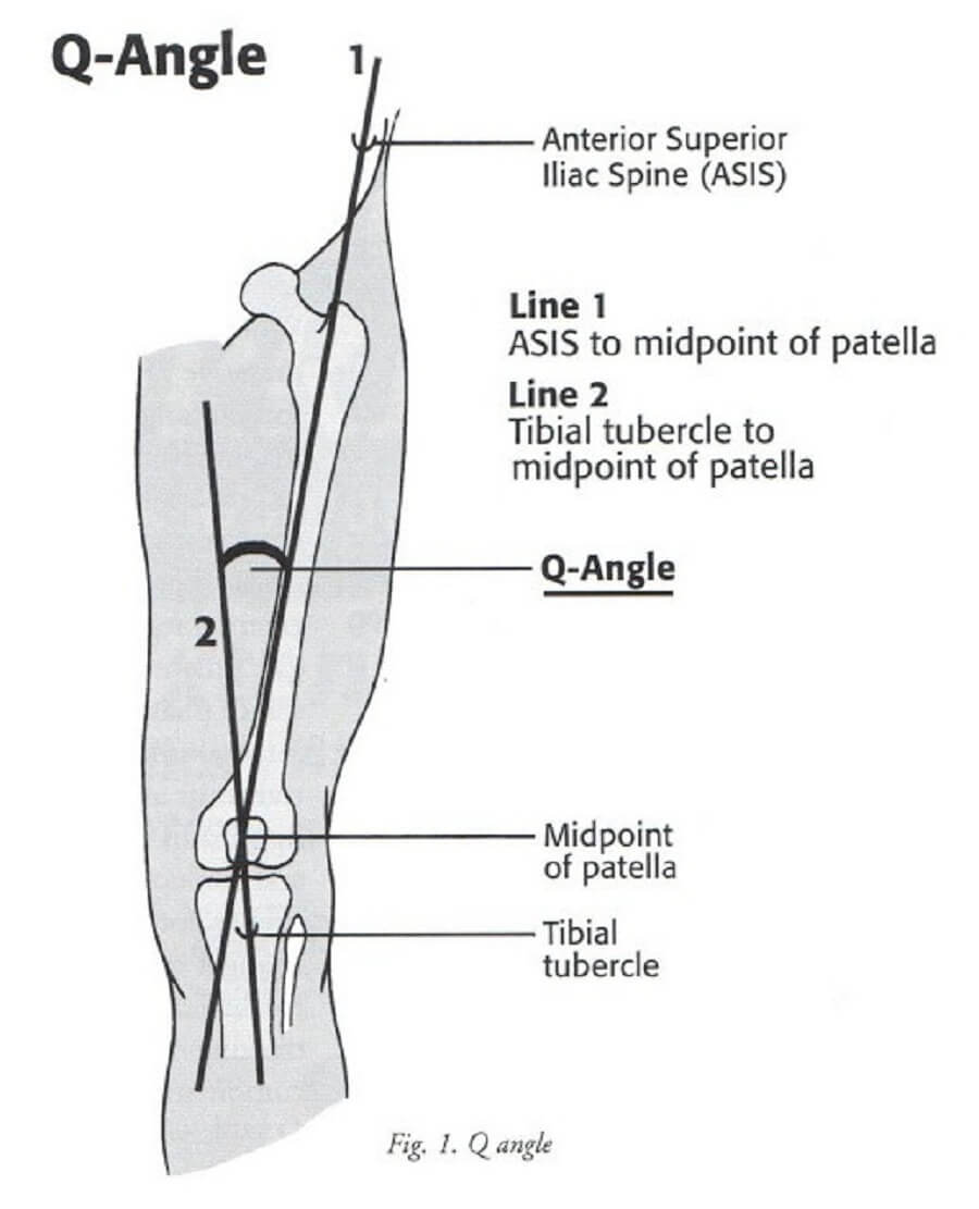 Spring-mountedBIUS1-浮動踏板