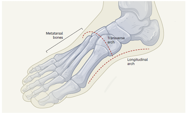 足弓的重要性