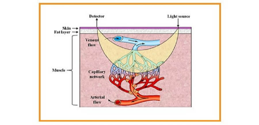 BSXInsight-穿戴式馬力計