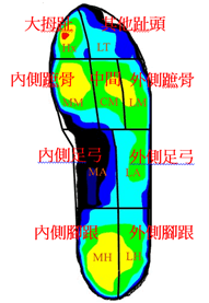 快走腳步的變化與隱藏的風險