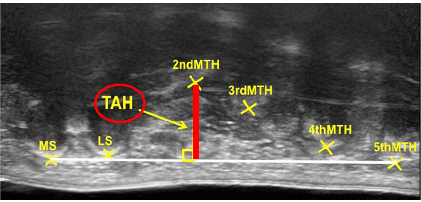 橫弓的重要性不亞於縱弓