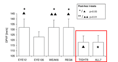 綁鞋帶的方式對跑步的影響原來這麼大!