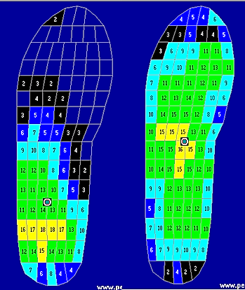 慢跑鞋的順暢感